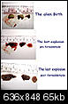 Nasal cancer-tissue-samples.jpg